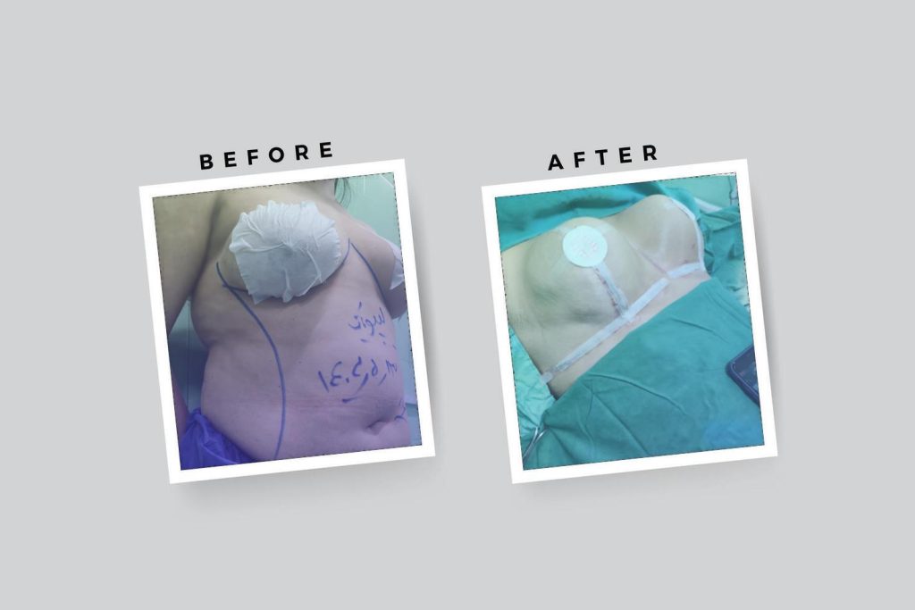 before-and-after-frame-template-free-vector